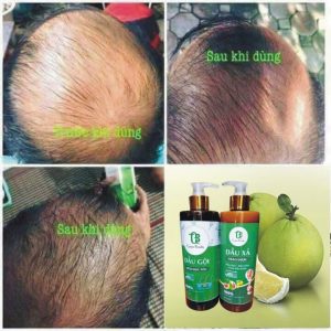 z6027493749794 5cf5848cf6348aabbdba3674f88eb09b